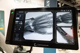 European Congress of Radiology 2026